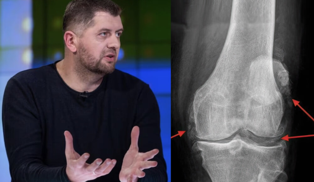 “un fotocolaj al unui bărbat la interviu și o radiografie a genunchiului